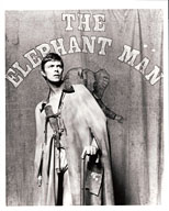 thumbnail link to original David Bowie Associated Press photograph The Elephant Man.